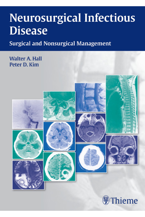 NEUROSURGICAL INFECTIOUS DISEASE