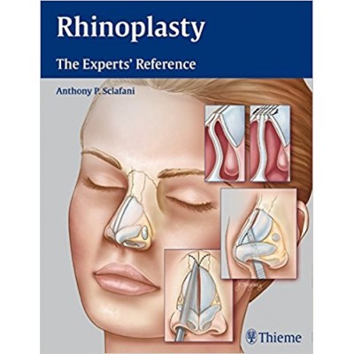 Rhinoplasty: The Experts' Reference: 1/e