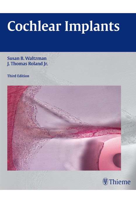Cochlear Implants, 3rd Edition