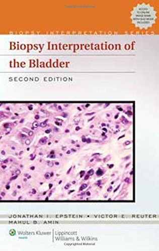 Biopsy Interpretation Of The Bladder (Biopsy Interpretation Series) (Old Edition)