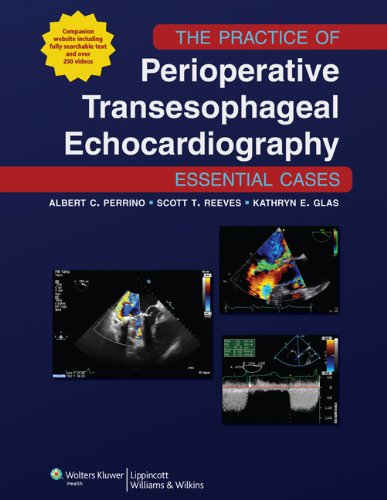 The Practice Of Perioperative Transesophageal Echocardiography: Essential Cases, /E