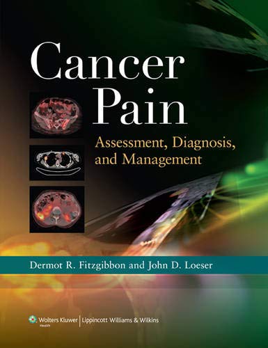 Cancer Pain: Assessment, Diagnosis, And Management (Old Edition)