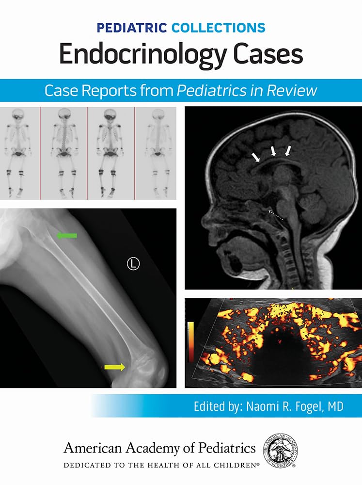 Pediatric Collections Endocrinology Cases Case Reports From Pediatrics In Review (Pb 2025)