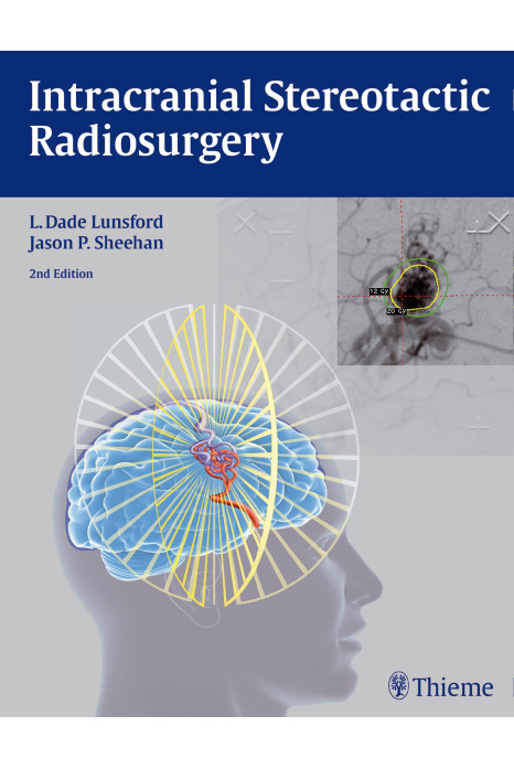 Intracranial Stereotactic Radiosurgery 2nd Edition