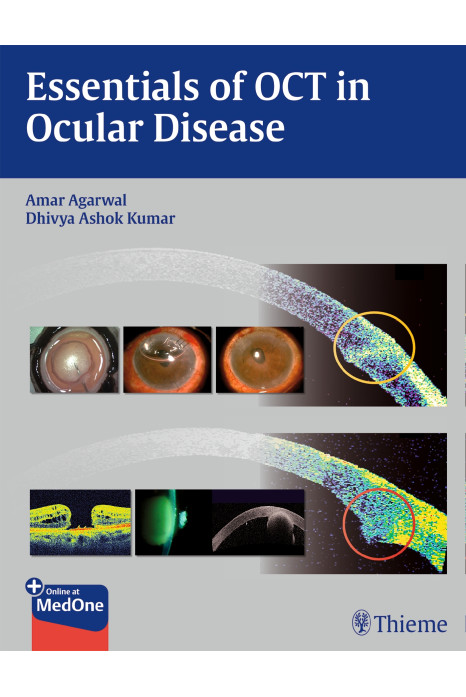 Essentials of OCT in Ocular Disease 