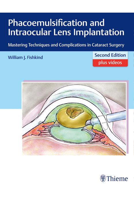 Phacoemulsification and Intraocular Lens Implantation 2nd Edition