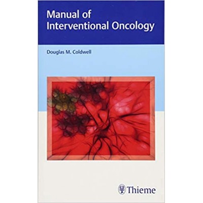 Manual of Interventional Oncology: 1/e