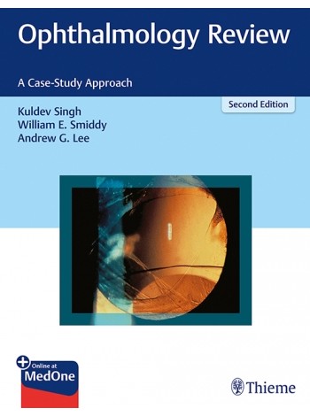Ophthalmology Review: A Case-Study Approach: 2/e