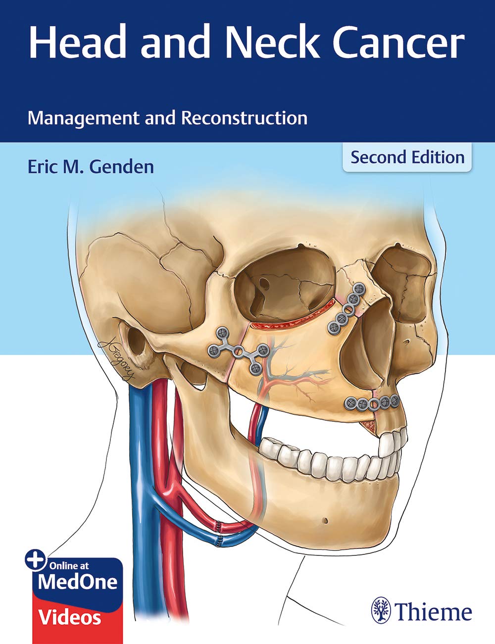 Head And Neck Cancer: Management And Reconstruction: 2/E