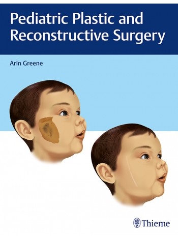 Pediatric Plastic and Reconstructive Surgery: 1/e