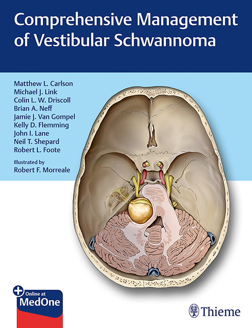 Comprehensive Management Of Vestibular Schwannoma: 1/E