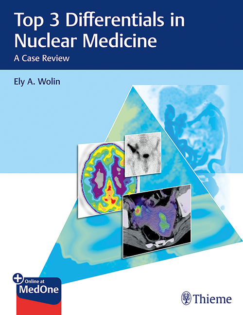 Top 3 Differentials In Nuclear Medicine - A Case Review: 1/E
