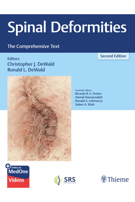 Spinal Deformities : The Comprehensive Text, 2nd Edition