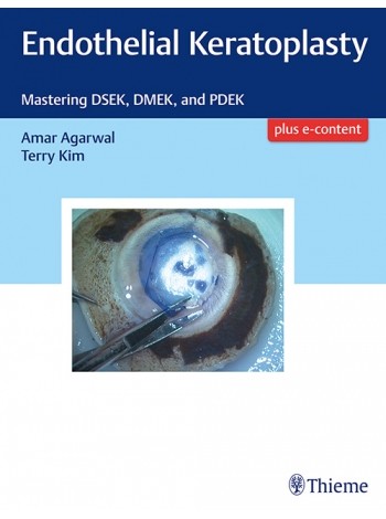 Endothelial Keratoplasty: Mastering DSEK, DMEK, and PDEK: 1/e