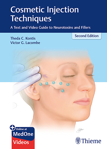 Cosmetic Injection Techniques: A Text And Video Guide To Neurotoxins And Fillers: 2/E