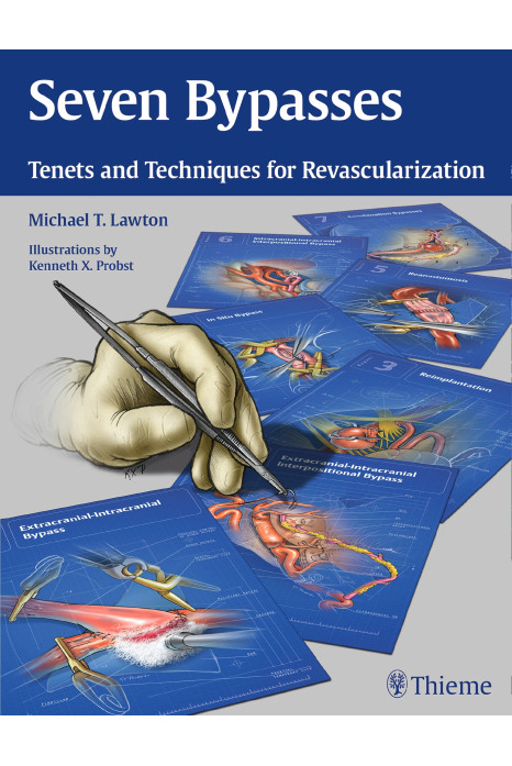 Seven Bypasses Tenets and Techniques for Revascularization 1st Ed.