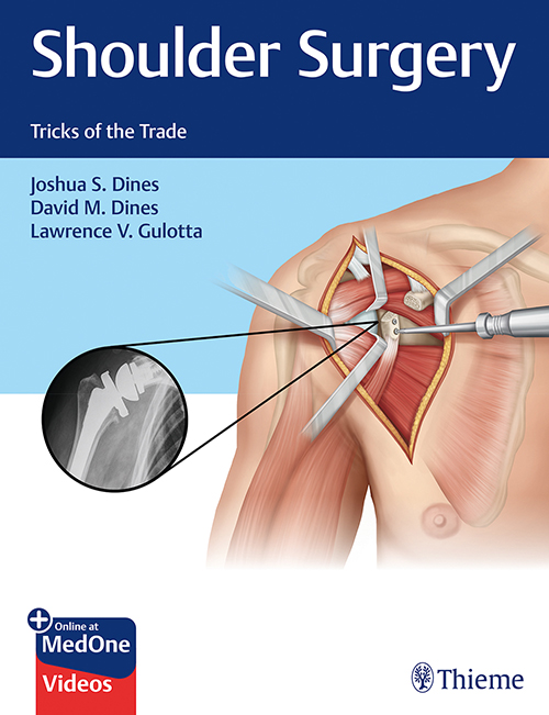 Shoulder Surgery - Tricks Of The Trade: 1/E