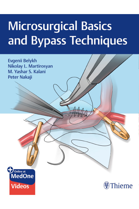 Microsurgical Basics and Bypass Techniques 1st Ed.