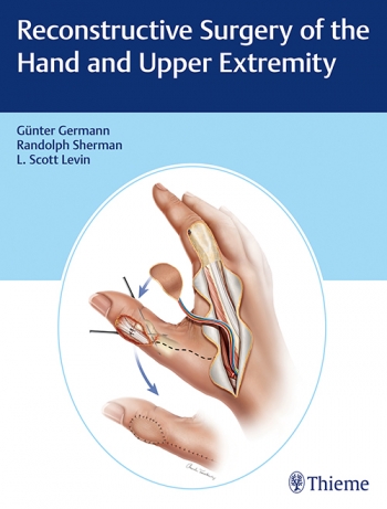 Reconstructive Surgery Of The Hand And Upper Extremity: 1/E