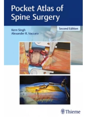 Pocket Atlas of Spine Surgery: 2/e