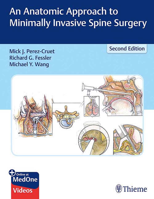 An Anatomic Approach To Minimally Invasive Spine Surgery: 2/E