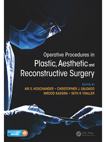 Operative Procedures in Plastic, Aesthetic and Reconstructive Surgery: 1/e