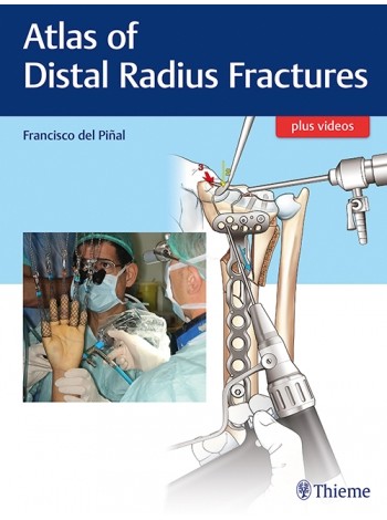 Atlas of Distal Radius Fractures: 1/e