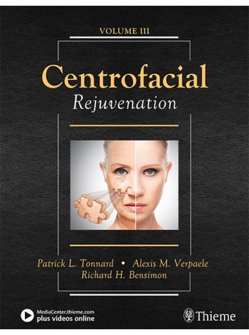 Centrofacial Rejuvenation: 1/e