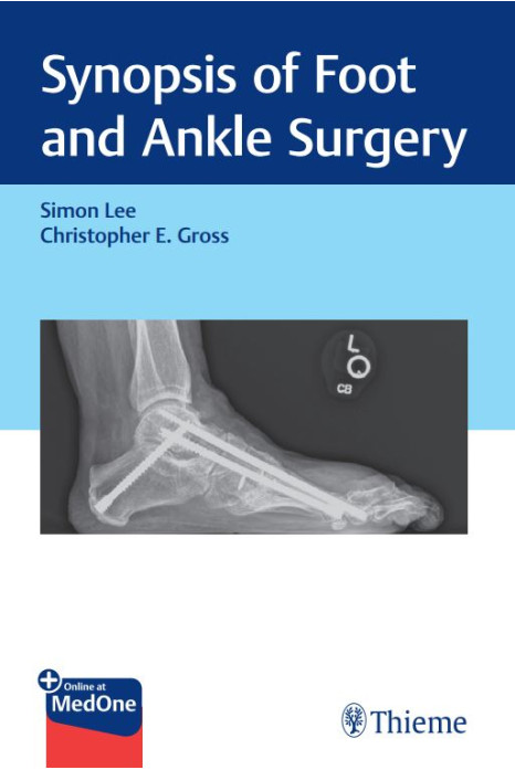Synopsis of Foot and Ankle Surgery 1st Ed.