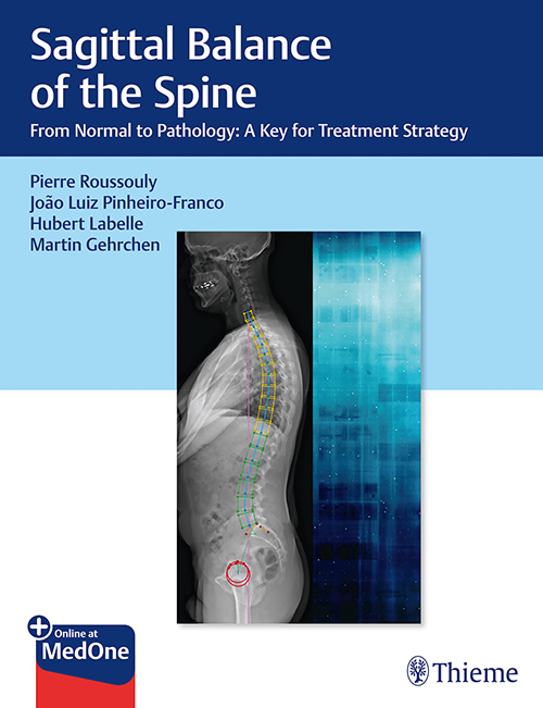 Sagittal Balance Of The Spine: 1/E