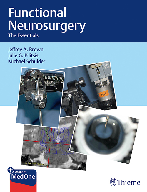 Functional Neurosurgery: 1/E