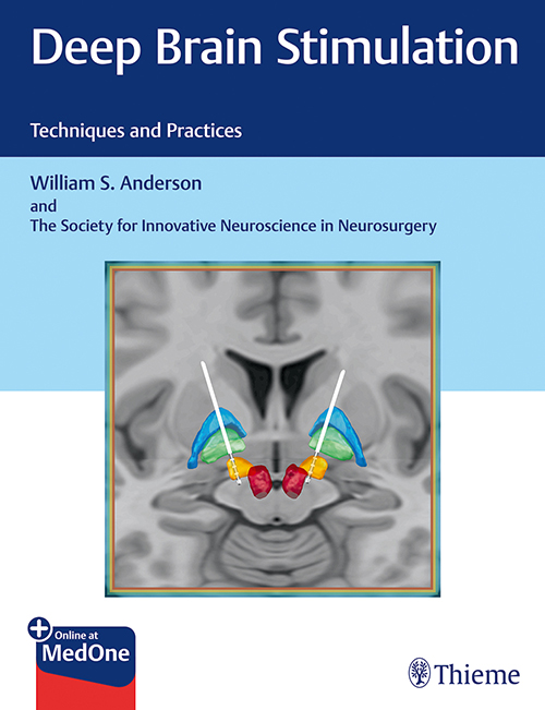 Deep Brain Stimulation : Techniques And Practices: 1/E