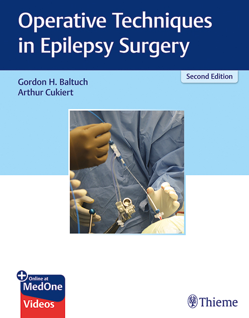 Operative Techniques In Epilepsy Surgery: 2/E