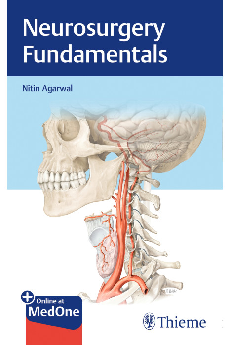 Neurosurgery Fundamentals 1st Ed.