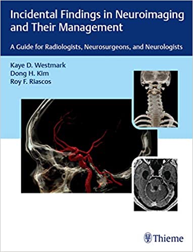 Incidental Findings In Neuroimaging And Their Management: A Guide For Radiologists, Neurosurgeons, And Neurologists