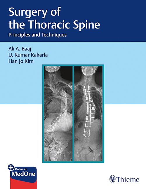 Surgery Of The Thoracic Spine: 1/E