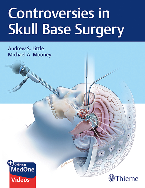 Controversies In Skull Base Surgery : 1/E.