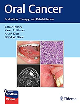 Oral Cancer : Evaluation, Therapy, And Rehabilitation
