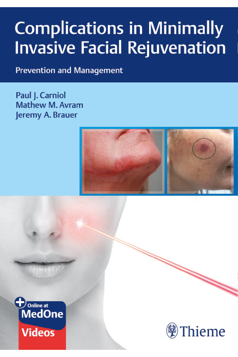 Complications in Minimally Invasive Facial Rejuvenation 1st Ed.