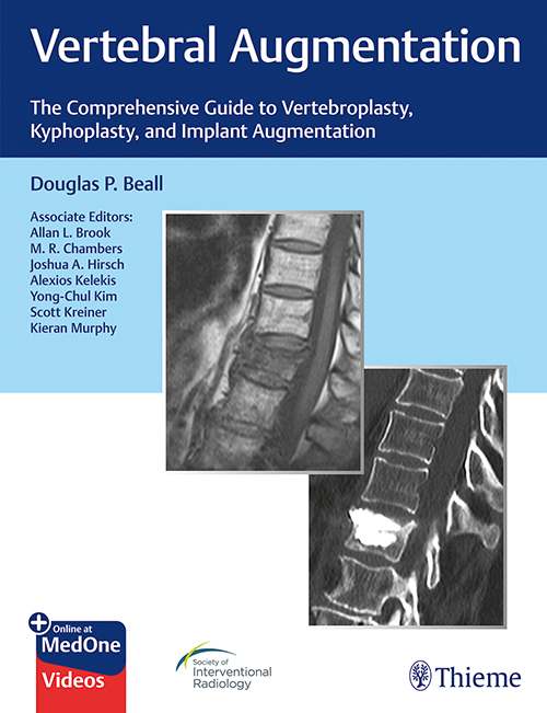 Vertebral Augmentation: The Comprehensive Guide To Vertebroplasty, Kyphoplasty, And Implant Augmentation