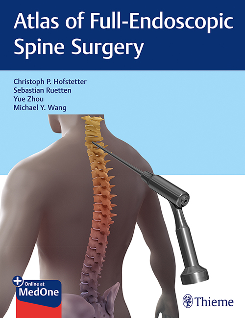 Atlas Of Full-Endoscopic Spine Surgery: 1/E