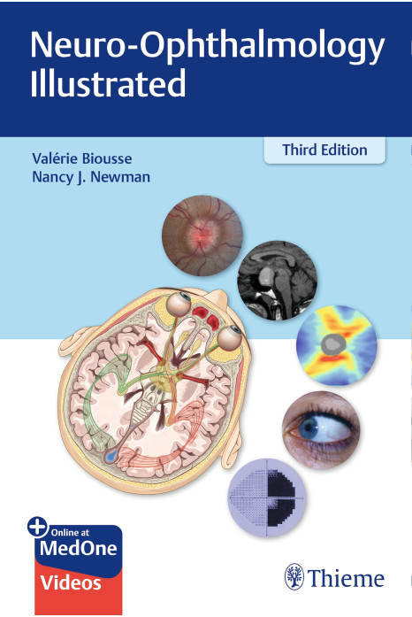 Neuro-Ophthalmology IIIustrated 3rd Edition