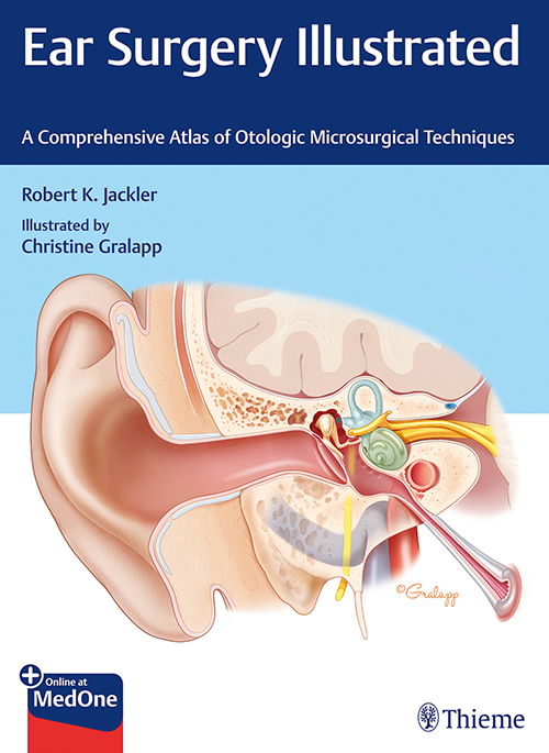 Ear Surgery Illustrated: 1/E
