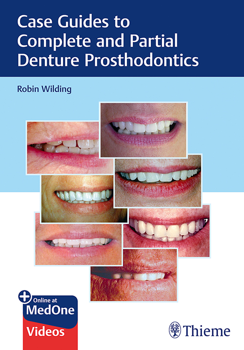 Case Guides To Complete And Partial Denture Prosthetics: 1/E