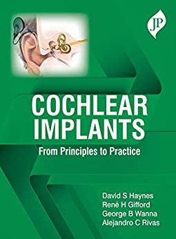 Cochlear Implants: From Principles To Practice