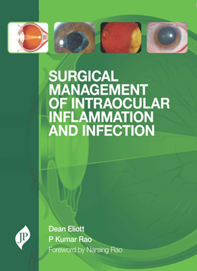 Surgical Management Of Intraocular Inflammation And Infection