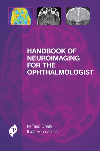 Handbook Of Neuroimaging For The Ophthalmologist