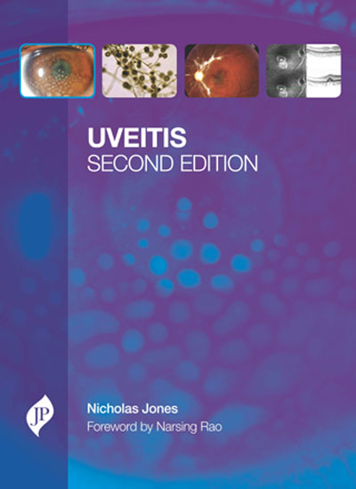 Uveitis With Cd-Rom