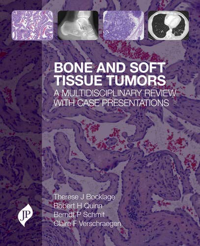 Bone And Soft Tissue Tumors:A Multidisciplinary Review With Case Presentations