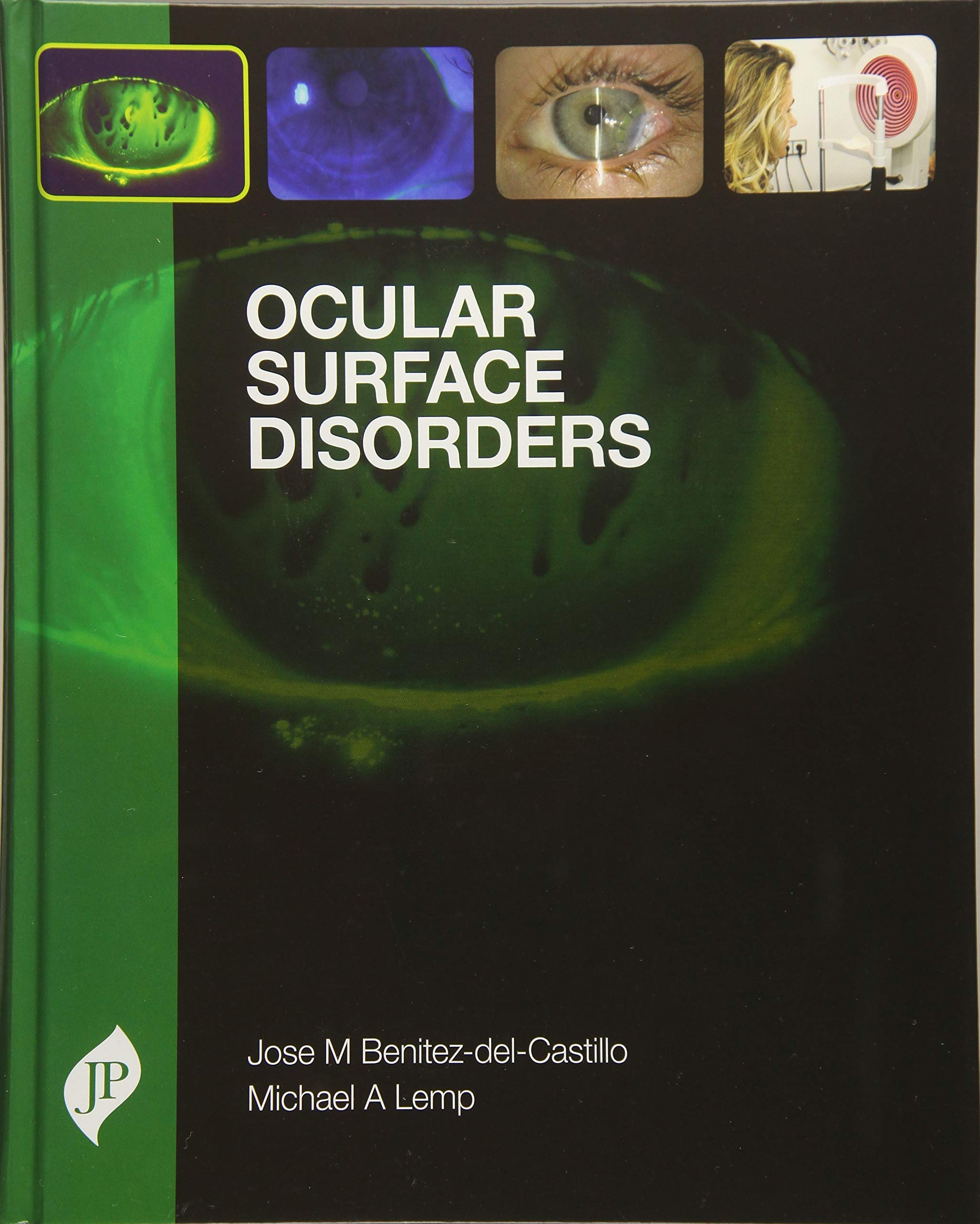 Ocular Surface Disorders
